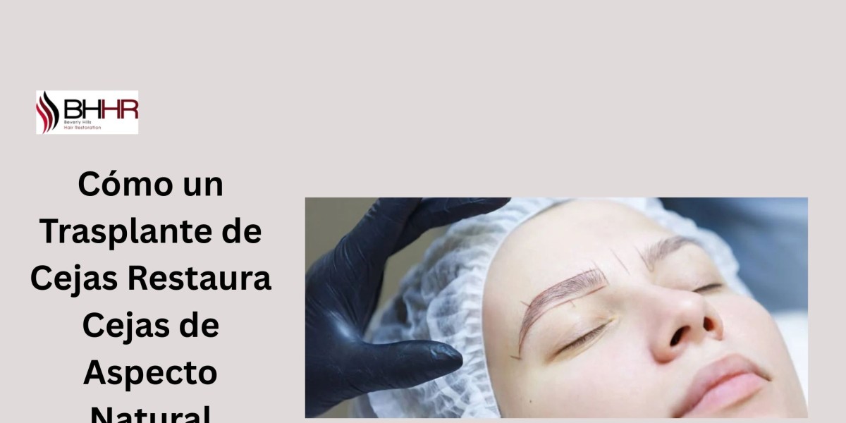 Cómo un Trasplante de Cejas Restaura Cejas de Aspecto Natural